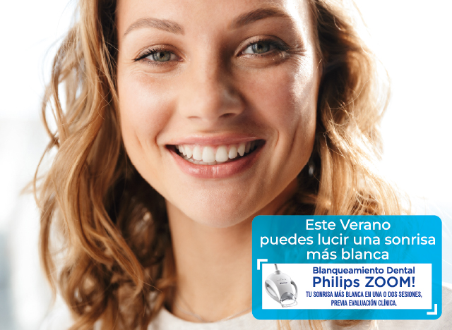 blanqueamiento dental