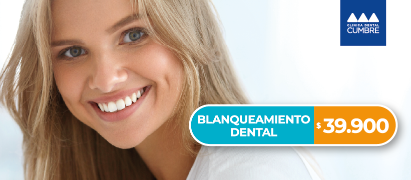 blanqueamiento