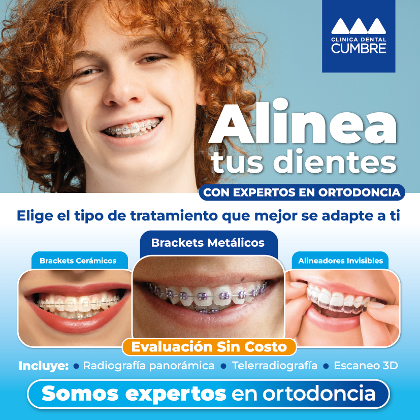 Brackets Metalicos