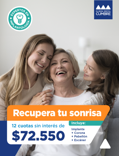 Promoción - Recupera tu Sonrisa $72.550