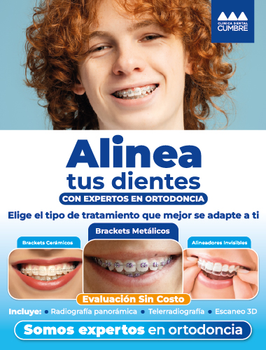 Promoción - Brackets Metálicos